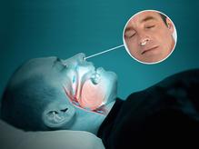 Nuit Paisible™ - Stop Ronflement